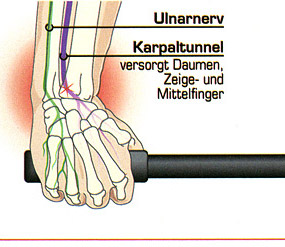 Handstellung von oben: falsch