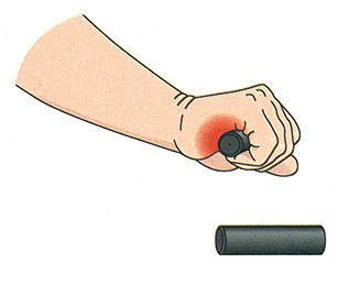 Handstellung seitlich: falsch